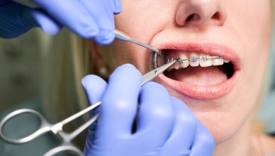 Mutuelles pour l'orthodontie